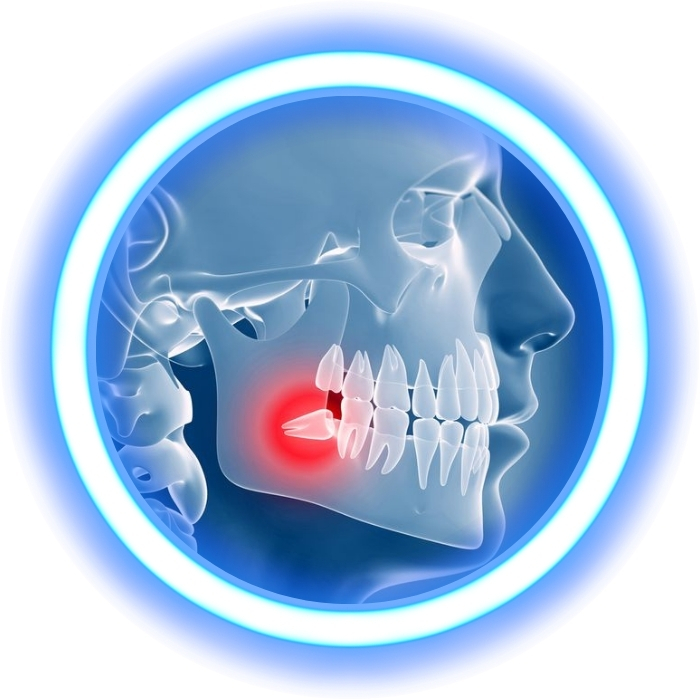 Maxilofacial Belmont Maxilofacial Belmont
